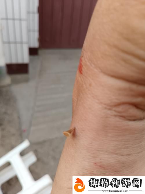 H多p太深拔出來痛怎么辦:緩解疼痛的小貼士